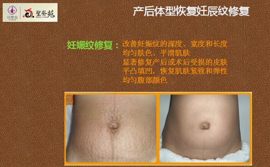 妊辰修复